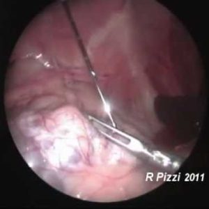 laparoscopic guided kidney biopsy in a dog